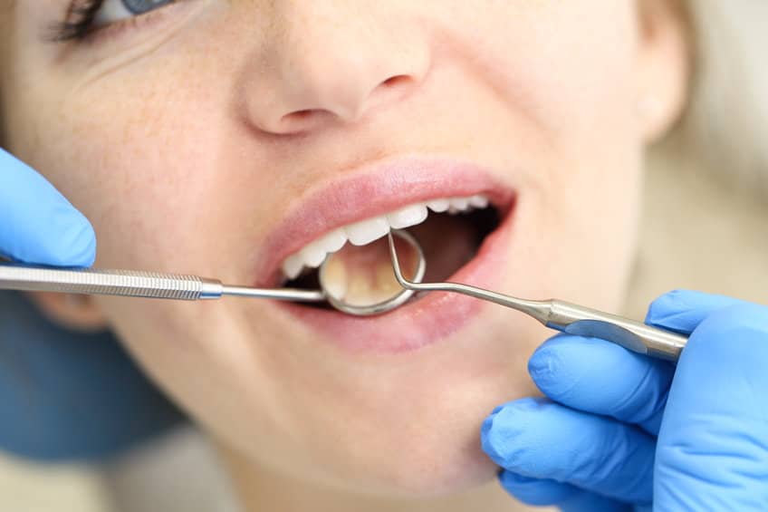5 Tips to Find the Best Dentist Near Mattapan, MA